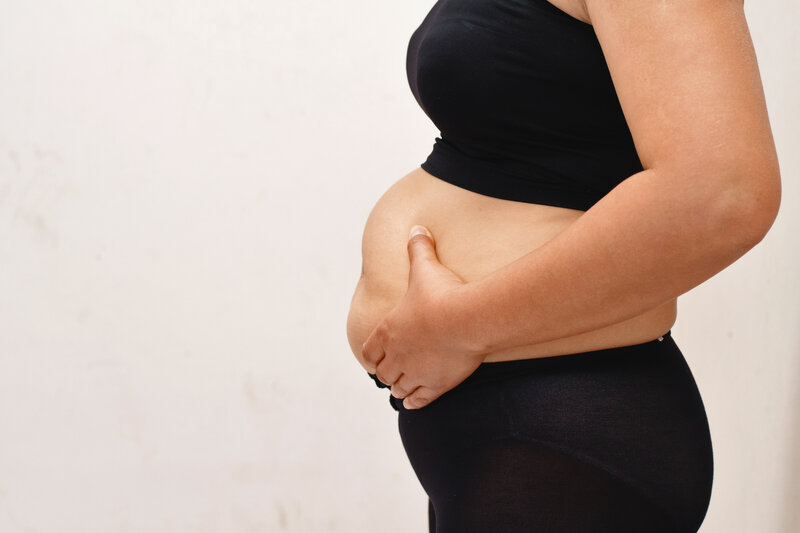 É possível realizar uma segunda cirurgia bariátrica